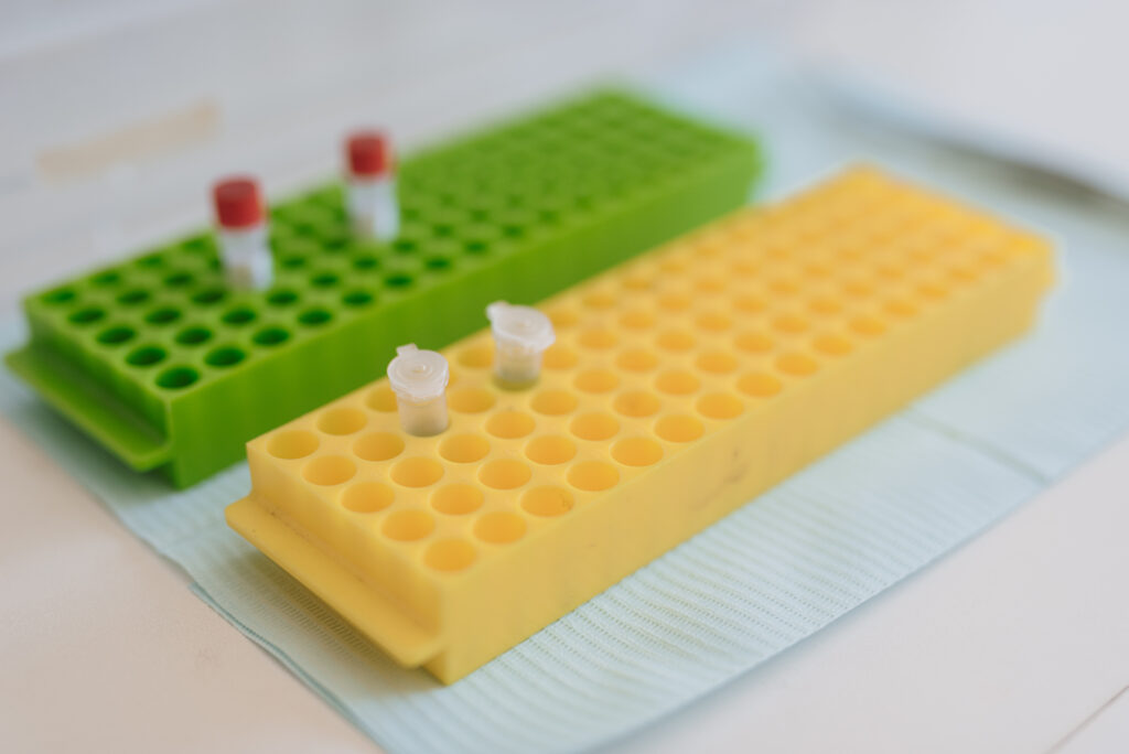 Tumores Odontogénicos en América del Sur: Estudio epidemiológico sin precedentes es liderado por la Facultad de Odontología