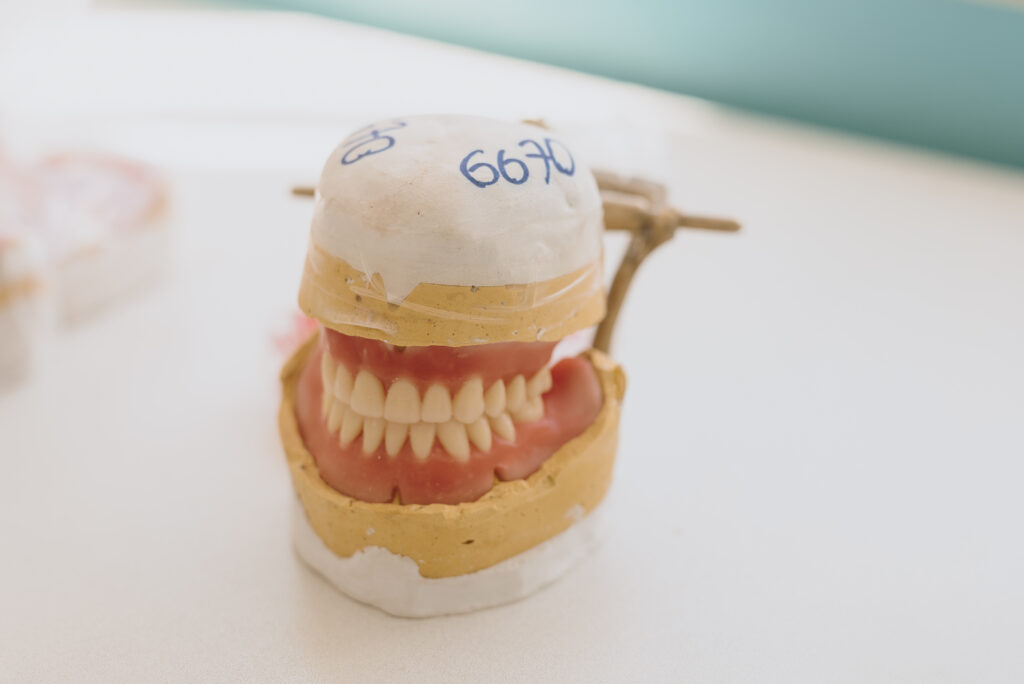 Docente de Facultad de Odontología participa en investigación publicada en The Lancet Regional Health – Europe sobre edentulismo