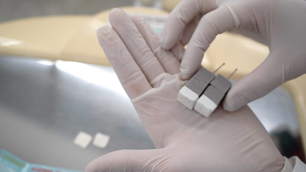 Subunidad de Fisiología de la FO desarrolla investigación clínica sobre acupuntura y dolor cráneo-mandibular